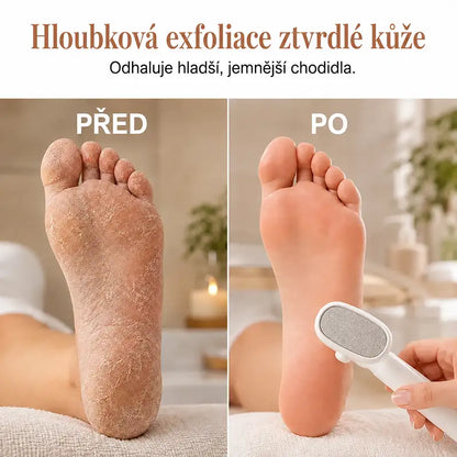 |⚡2026 Obří Sleva 70% OFF🔥| ✨Oboustranná škrabka na chodidla pro odstraňování ztvrdlé kůže - Odstraňovač mozolů jedním tahem💫