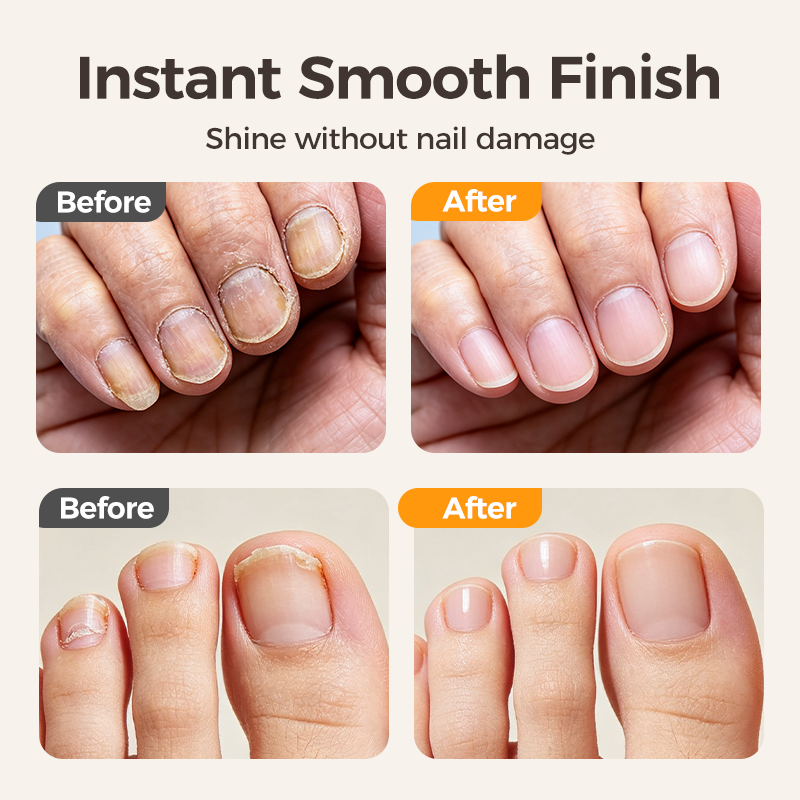 | ✂️ ČASO VĚ OMEZENÁ SLEVA 70 %! ✨💅 Elektrický zastřihovač a leštička na nehty 2v1 Smart 🌟