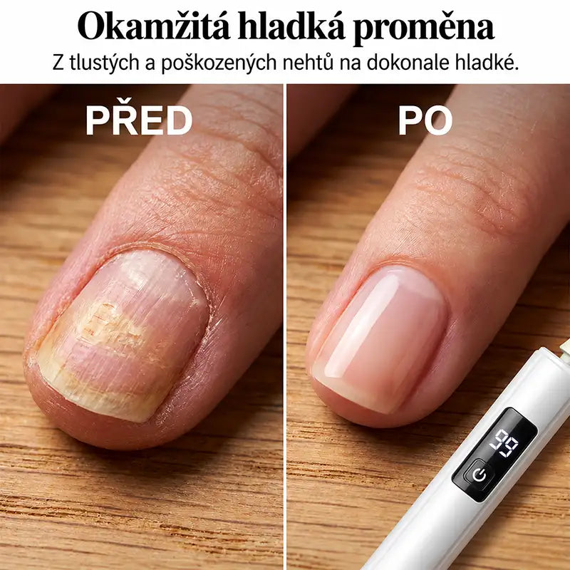 |⚡2026 Obří Sleva 70% OFF🔥|✨PurieJoy® Profesionální Elektrický Pilník a Leštička na Nehty 2 v 1